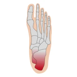 Fersenschutzbandage universal