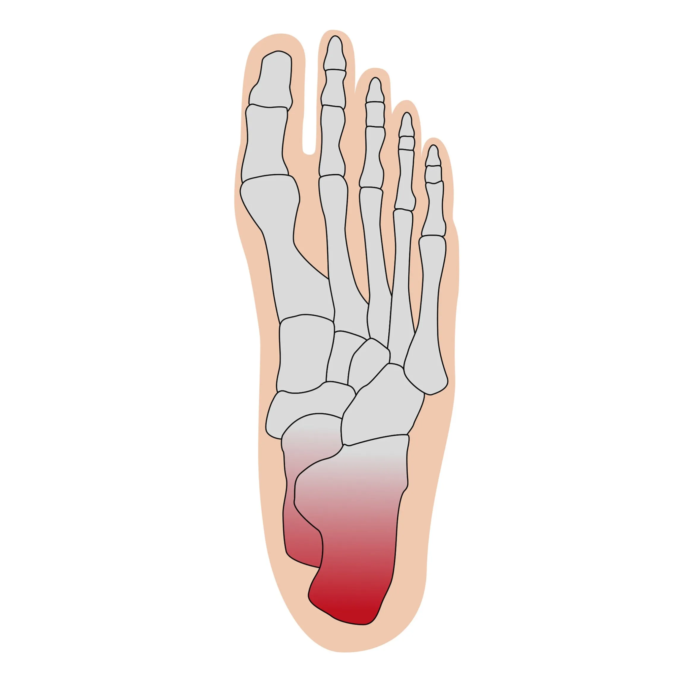 Fersenschutzbandage universal