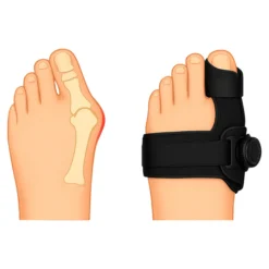 Hallux-Valgus-Bandage „variabel“, 1 Paar