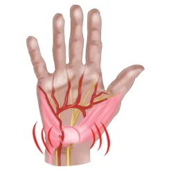 Handgelenkbandage "Karpal" links