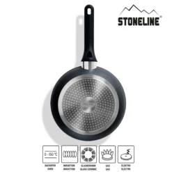 STONELINE Kochgeschirr-Set 11-teilig 18/20/24 Roségold | mit Deckeln